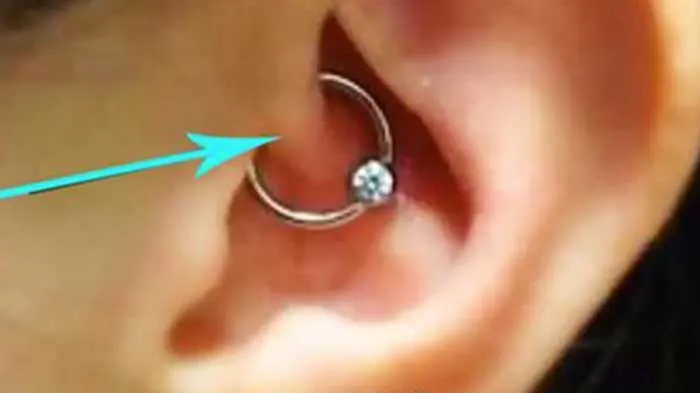 People Are Using Piercings To Relieve Chronic Migraine Symptoms