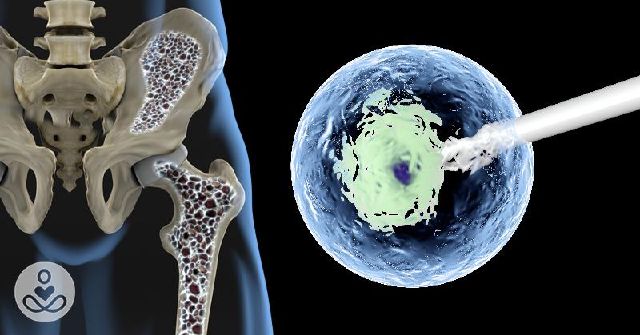 14744697 new stem cell therapy could prevent bone f007928a m