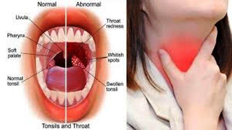 Have You Ever Thought Why Your Throat Itches At The Time Of Cough Cold