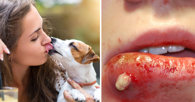 Here’s Why It’s Important To NEVER Let Your Dog Lick You