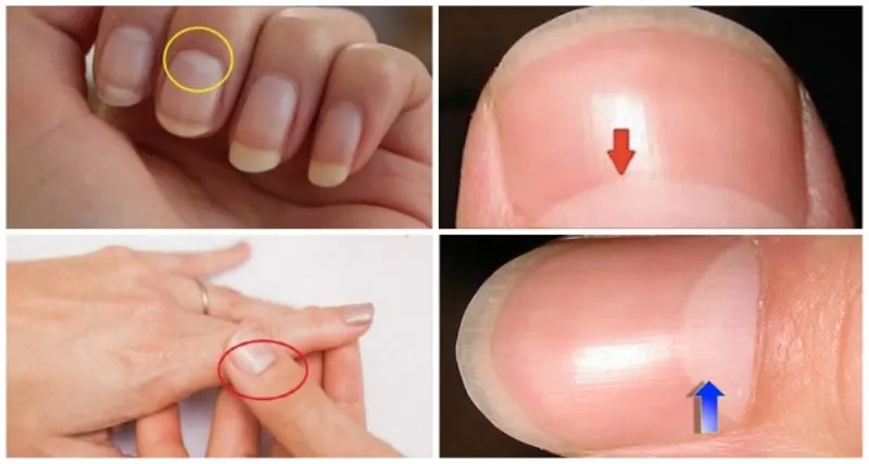 This Is What The Half Moon Shape On Your Nails Mea