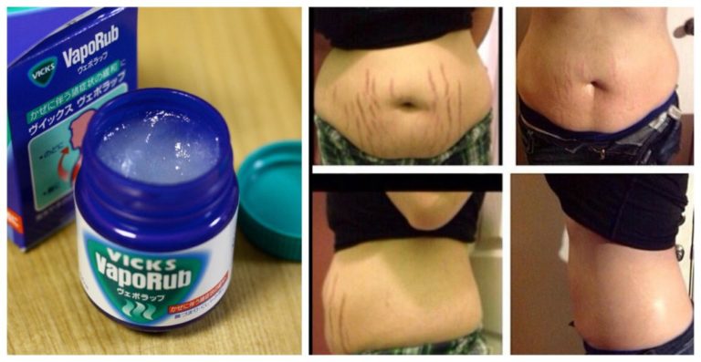 HOW TO USE VICKS VAPORUB TO GET RID OF ACCUMULATED BELLY FAT AND CELLULITE ELIMINATE STRETCH MARKS AND HAVE FIRMER SKI