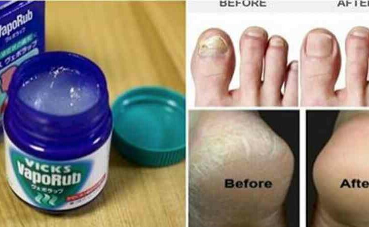 She Applies Vicks Vaporub On Her Feet Before Bed; When You Know The Reason, You will Do The Same!