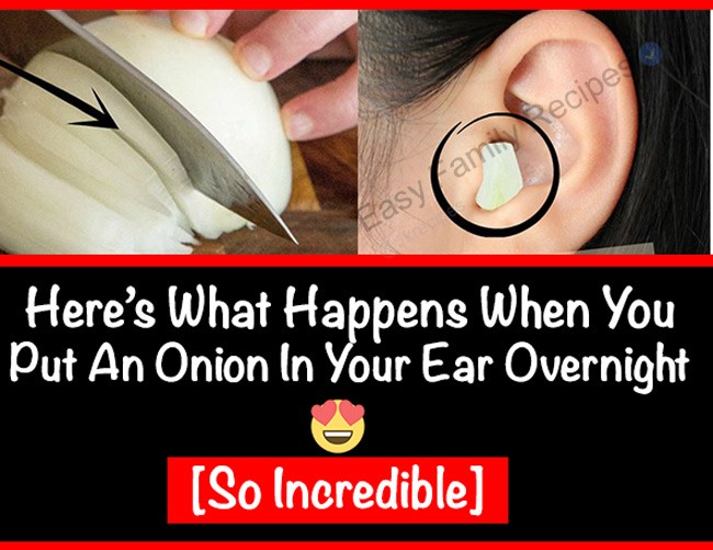 Here’s What Happens When You Put An Onion In Your Ear Overnight 7 insurance agency, insurance near me, kemper insurance, long term care insurance, medical insurances, progressive insurance quote, term life insurance, whole life insurance, aaa car insurance, alfa insurance, auto insurance company, cigna insurance, direct insurance, farmers insurance login, fred loya insurance, geico home insurance, grange insurance, hanover insurance, insurance companies near me, life insurance companies, life insurance quotes, mapfre insurance, motorcycle insurance, new york life insurance, progressive insurance phone number, pronto insurance, safety insurance, state farm auto insurance, statefarm insurance, the general auto insurance, adriana's insurance, affordable health insurance, aflac insurance, american national insurance, ameriprise insurance, assurant insurance, auto insurance companies, best car insurance, best pet insurance, california department of insurance, cheap health insurance, chubb insurance, commerce insurance, disability insurance, dog insurance, embrace pet insurance, geico insurance phone number, guardian dental insurance, hagerty insurance, health insurance companies, health insurance for individual, insurance agents near me, insurance auto auction, insurance marketplace, la insurance, liability insurance, life insurance for seniors, life insurance policy, metlife insurance, njm insurance, safeway insurance