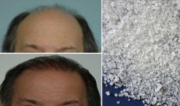 IT ONLY TAKES ONE INGREDIENT TO SAVE AND REGROW YOUR HAIR